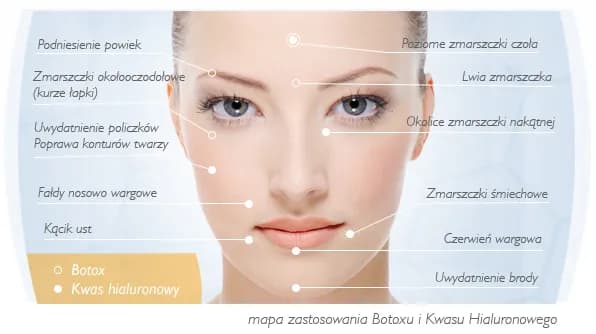 Gdzie wstrzykuje się kwas hialuronowy? Miejsca, efekty i bezpieczeństwo zabiegów