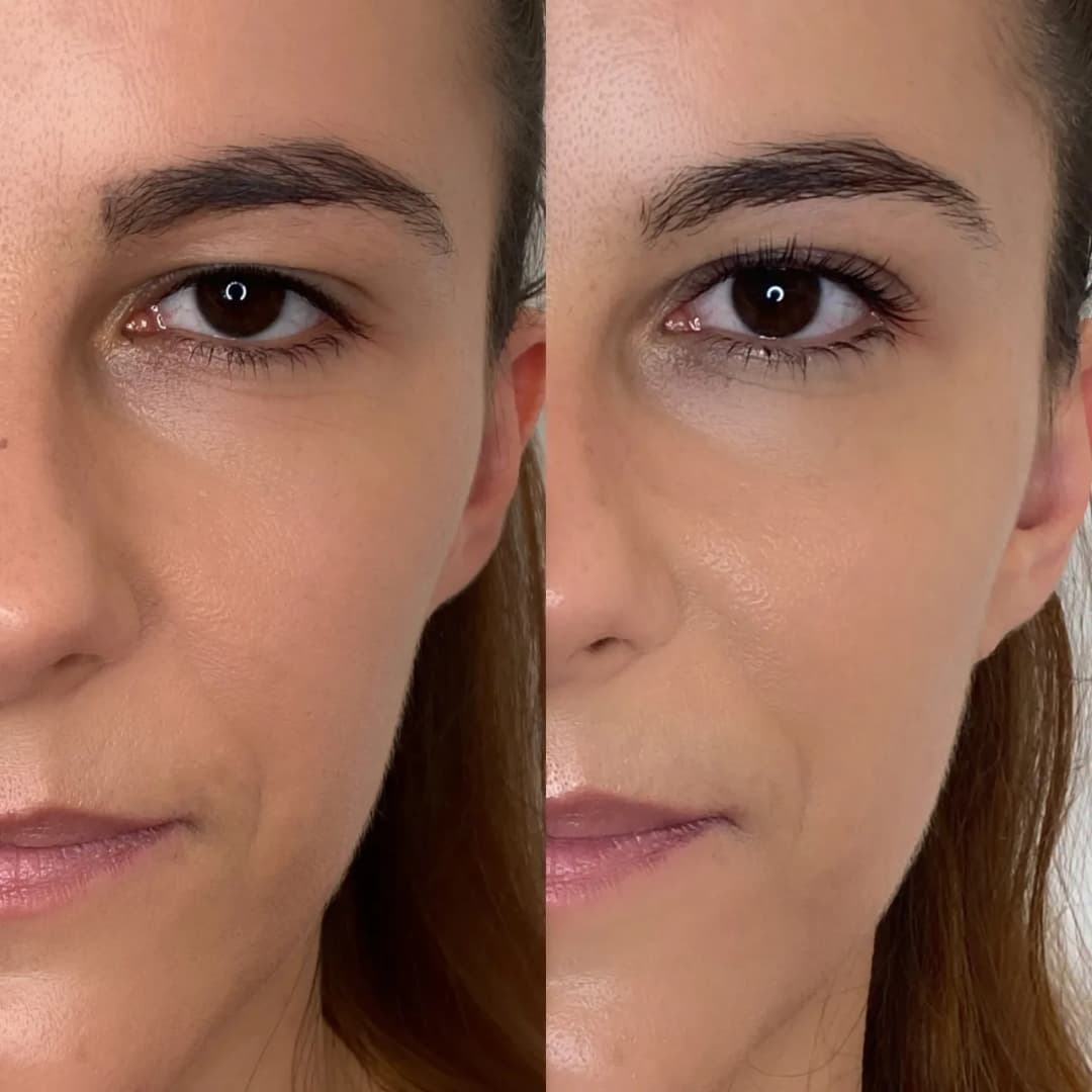 Laminacja rzęs na czym polega: efekty, proces i korzyści dla rzęs